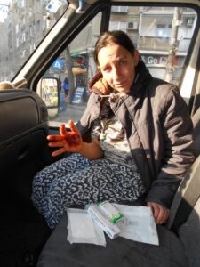 Woman with injured hand in car with bandages.